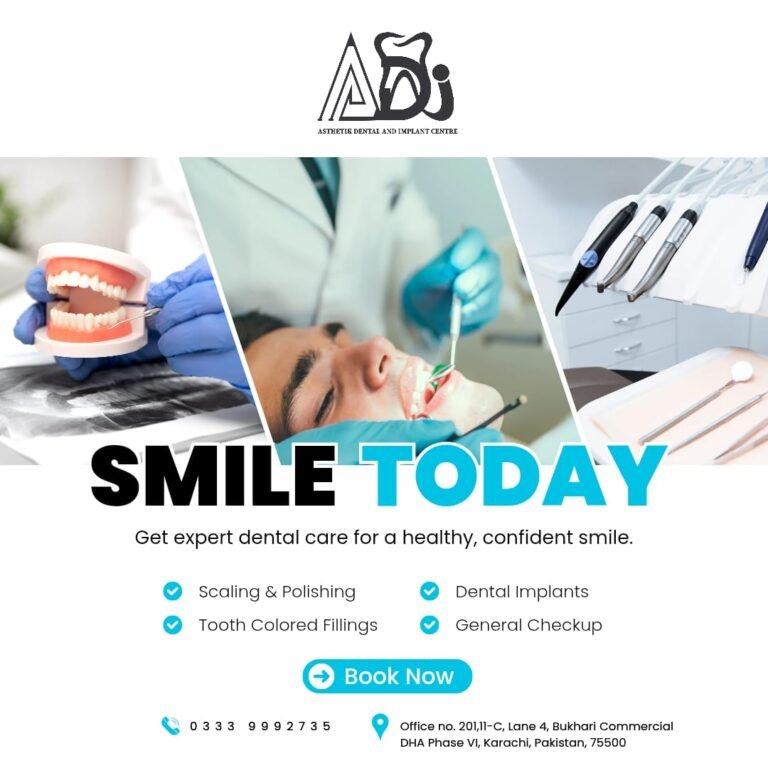 Dental Implant Cost in Pakistan
